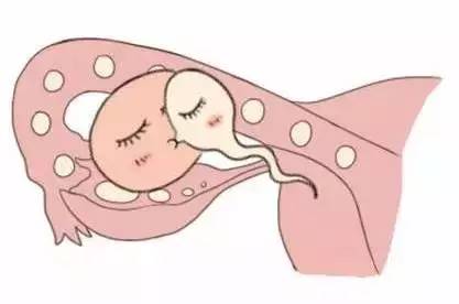 试管婴儿供卵代生咨询